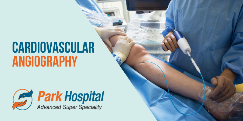 What is Cardiovascular Angiography?