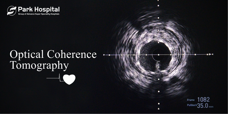 Optical Coherence Tomography