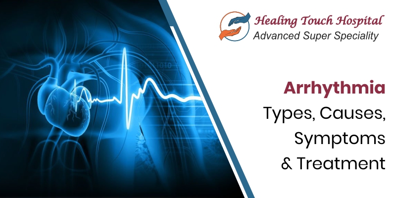 Arrhythmia: Causes, Diagnosis, Symptoms, and Treatment